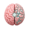 Stroke Technology